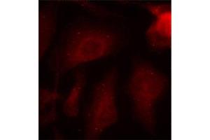 Immunofluorescence (IF) image for anti-Microtubule-Associated Protein tau (MAPT) (pSer404) antibody (ABIN1870403)
