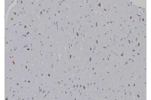 ABIN6277195 at 1/100 staining Human heart tissue by IHC-P. (Histone 3 antibody  (H3K9me))