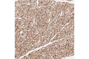 Immunohistochemical staining of human heart muscle with MAGED4B polyclonal antibody  shows strong membranous and cytoplasmic positivity in myocytes.