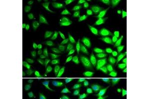 Immunofluorescence analysis of U2OS cells using PDIA6 Polyclonal Antibody (PDIA6 antibody)