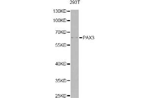 Western blot analysis of extracts of 293T cells, using PAX3 antibody (ABIN6290725) at 1:1000 dilution.