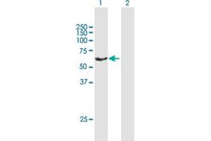 Western Blot analysis of RAP1GDS1 expression in transfected 293T cell line by RAP1GDS1 MaxPab polyclonal antibody. (RAP1GDS1 antibody  (AA 1-607))