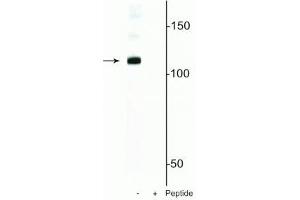 Western blot of mouse nuclei lysate showing specific immunolabeling of the ~120 kDa DGCR8 protein phosphorylated at in the first lane (-). (DGCR8 antibody  (pSer377))