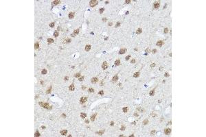 Immunohistochemistry of paraffin-embedded Rat brain using MYOCD antibody (ABIN7268730) at dilution of 1:100 (40x lens). (Myocardin antibody  (AA 650-750))