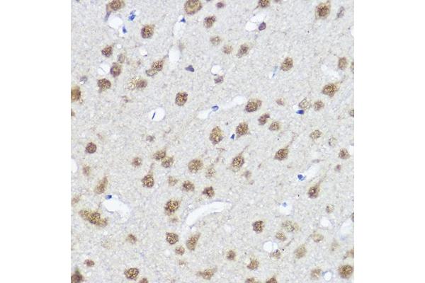 Myocardin antibody  (AA 650-750)