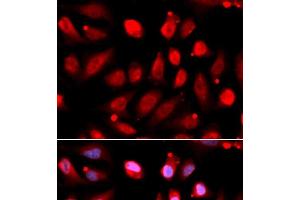 Immunofluorescence analysis of U2OS cells using EZH2 Polyclonal Antibody (EZH2 antibody)
