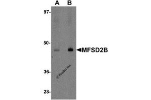 Western Blotting (WB) image for anti-Major Facilitator Superfamily Domain Containing 2B (MFSD2B) (Middle Region) antibody (ABIN1031004) (MFSD2B antibody  (Middle Region))