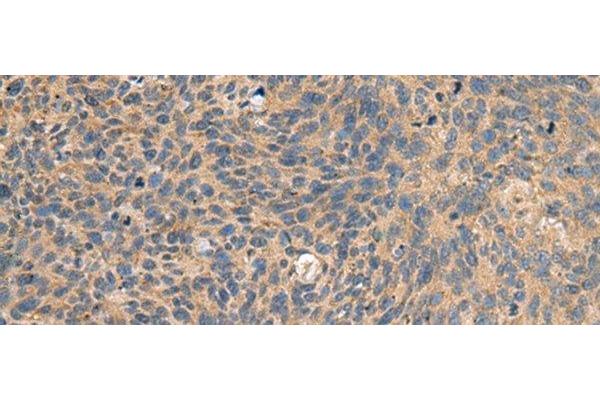 EIF1AX antibody