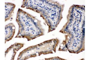Anti- POR Picoband antibody,IHC(P) IHC(P): Mouse Intestine Tissue (POR antibody  (C-Term))