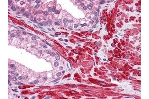 Human Prostate: Formalin-Fixed, Paraffin-Embedded (FFPE) (DPP8 antibody)