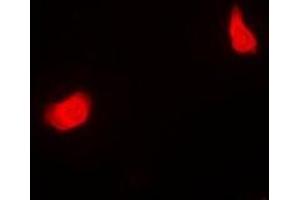 Immunofluorescent analysis of PSMC5 staining in MCF7 cells. (PSMC5 antibody)