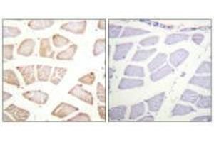 Immunohistochemistry analysis of paraffin-embedded human skeletal muscle tissue using Akt (Ab-129) antibody. (AKT1 antibody  (Ser129))