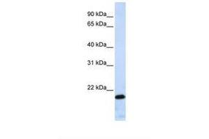Image no. 1 for anti-Zinc Finger Protein 428 (ZNF428) (AA 110-159) antibody (ABIN6739137) (ZNF428 antibody  (AA 110-159))