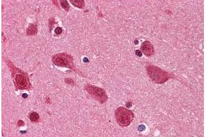 Human Brain, Cortex: Formalin-Fixed, Paraffin-Embedded (FFPE) (TARDBP antibody  (AA 1-261))