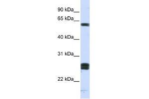 HABP2 antibody used at 1 ug/ml to detect target protein. (HABP2 antibody  (Middle Region))
