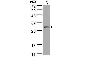 WB Image Sample (30 ug of whole cell lysate) A: A431 12% SDS PAGE antibody diluted at 1:1000 (PSPH antibody)