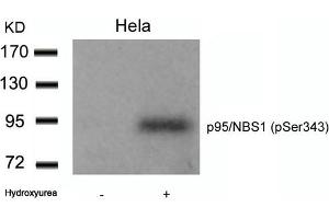 Western blot analysis of extracts from Hela cells untreated or treated with Hydroxyurea using p95/NBS1(Phospho-Ser343) Antibody. (Nibrin antibody  (pSer343))
