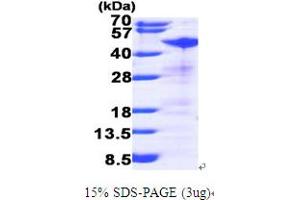 SDS-PAGE (SDS) image for Ribonucleotide Reductase M2 (RRM2) (AA 1-389) protein (His tag) (ABIN667014) (RRM2 Protein (AA 1-389) (His tag))