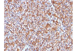 Formalin-fixed, paraffin-embedded human Pancreas stained with Spectrin beta III Mouse Monoclonal Antibody (SPTBN2/1778). (Spectrin, Beta, Non-erythrocytic 2 (SPTBN2) (AA 356-475) antibody)