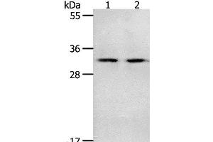 Western Blot analysis of Mouse spleen and intestinum crassum tissue using NME6 Polyclonal Antibody at dilution of 1:400 (NME6 antibody)