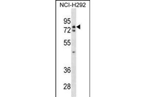WRNIP1 Antibody (N-term) (ABIN1538893 and ABIN2838140) western blot analysis in NCI- cell line lysates (35 μg/lane). (WRNIP1 antibody  (N-Term))