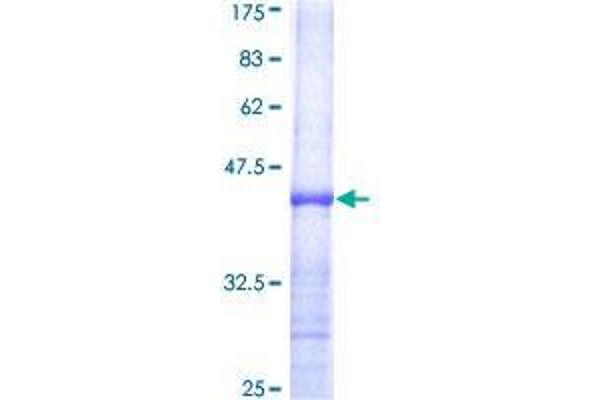 USP50 Protein (AA 101-210) (GST tag)