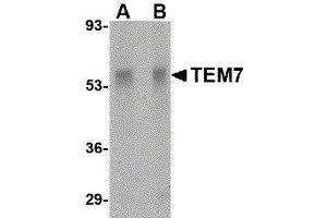 Western Blotting (WB) image for anti-Plexin Domain Containing 1 (PLXDC1) (Center) antibody (ABIN2476727) (PLXDC1 antibody  (Center))