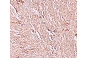 Immunohistochemical staining of human brain cells with ZBTB4 polyclonal antibody  at 2.
