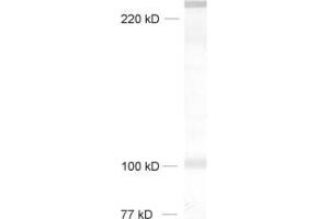 dilution: 1 : 1000, sample: rat brain homogenate (Neurobeachin antibody  (AA 952-1320))