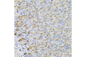 Immunohistochemistry of paraffin-embedded mouse stomach using LDHB antibody. (LDHB antibody  (AA 1-334))