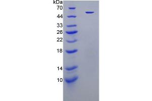 SDS-PAGE analysis of active recombinant Human ELA2. (ELANE Protein)