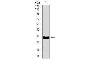 Image no. 2 for anti-Neurofilament, Heavy Polypeptide (NEFH) antibody (ABIN1491717)