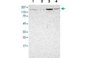 Western Blot analysis of Lane 1: RT-4, Lane 2: EFO-21, Lane 3: A-431 and Lane 4: human liver lysates with MAP3K9 polyclonal antibody .