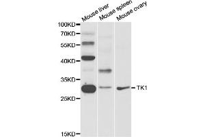 Western blot analysis of extracts of various cell lines, using TK1 antibody.