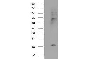 Image no. 5 for anti-Cystatin SA (CST2) antibody (ABIN1497759)