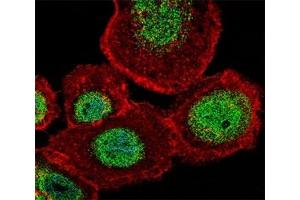 Fluorescent confocal image of A431 cell stained with LEF1 antibody at 1:25. (LEF1 antibody  (AA 10-37))