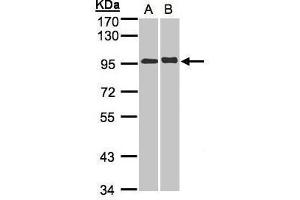 WB Image Sample(30 ug whole cell lysate) A:A431, B: Hep G2 , 7. (IL12RB2 antibody)