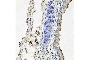 Immunohistochemistry of paraffin-embedded mouse lung using SLC39A4 antibody at dilution of 1:100 (x40 lens). (SLC39A4 antibody)