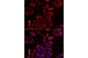 Immunofluorescence analysis of U2OS cell using PDLIM1 antibody. (PDLIM1 antibody)