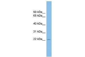 Host:  Rabbit  Target Name:  EBI3  Sample Tissue:  Human U937 Whole Cell  Antibody Dilution:  1ug/ml (EBI3 antibody  (Middle Region))