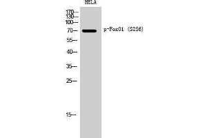 Western Blotting (WB) image for anti-Forkhead Box O1 (FOXO1) (pSer256) antibody (ABIN3172897) (FOXO1 antibody  (pSer256))