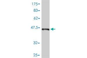 Western Blot detection against Immunogen (44 KDa) . (STK32A antibody  (AA 1-166))