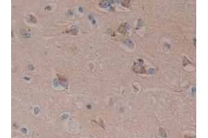 Detection of DKK3 in Human Brain Tissue using Polyclonal Antibody to Dickkopf Related Protein 3 (DKK3) (DKK3 antibody  (AA 22-350))