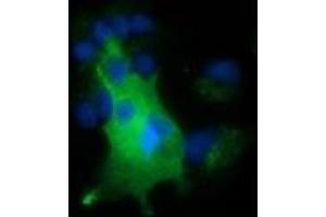 Anti-NUMB mouse monoclonal antibody (ABIN2453393) immunofluorescent staining of COS7 cells transiently transfected by pCMV6-ENTRY NUMB (RC216230). (NUMB antibody)