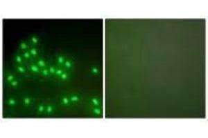 Immunofluorescence analysis of A549 cells, using Ku70/80 antibody.