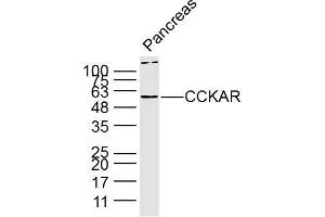 Lane 1: Mouse pancreas lysates probed with Anti CCKAR Polyclonal Antibody, Unconjugated (bs-11514R) at 1:300 overnight at 4˚C. (CCKAR antibody  (AA 161-200))