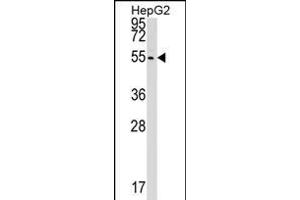 CLP1 Antibody (C-term) (ABIN1537107 and ABIN2848782) western blot analysis in HepG2 cell line lysates (35 μg/lane). (CLP1 antibody  (C-Term))