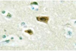 Immunohistochemistry (IHC) analyzes of LUCA15 antibody in paraffin-embedded human brain tissue. (RBM5 antibody)