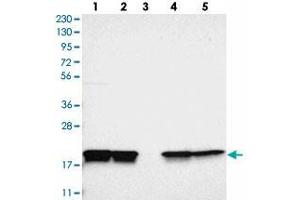 Western blot analysis of Lane 1: RT-4, Lane 2: U-251 MG, Lane 3: Human Plasma, Lane 4: Liver, Lane 5: Tonsil with PPIB polyclonal antibody . (PPIB antibody)