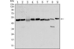 Western blot analysis using FOXD3 mouse mAb against NTERA-2 (1), HUVE-12 (2), HEK293 (3), Hela (4), Jurkat (5), K562 (6), RAW264. (FOXD3 antibody)
